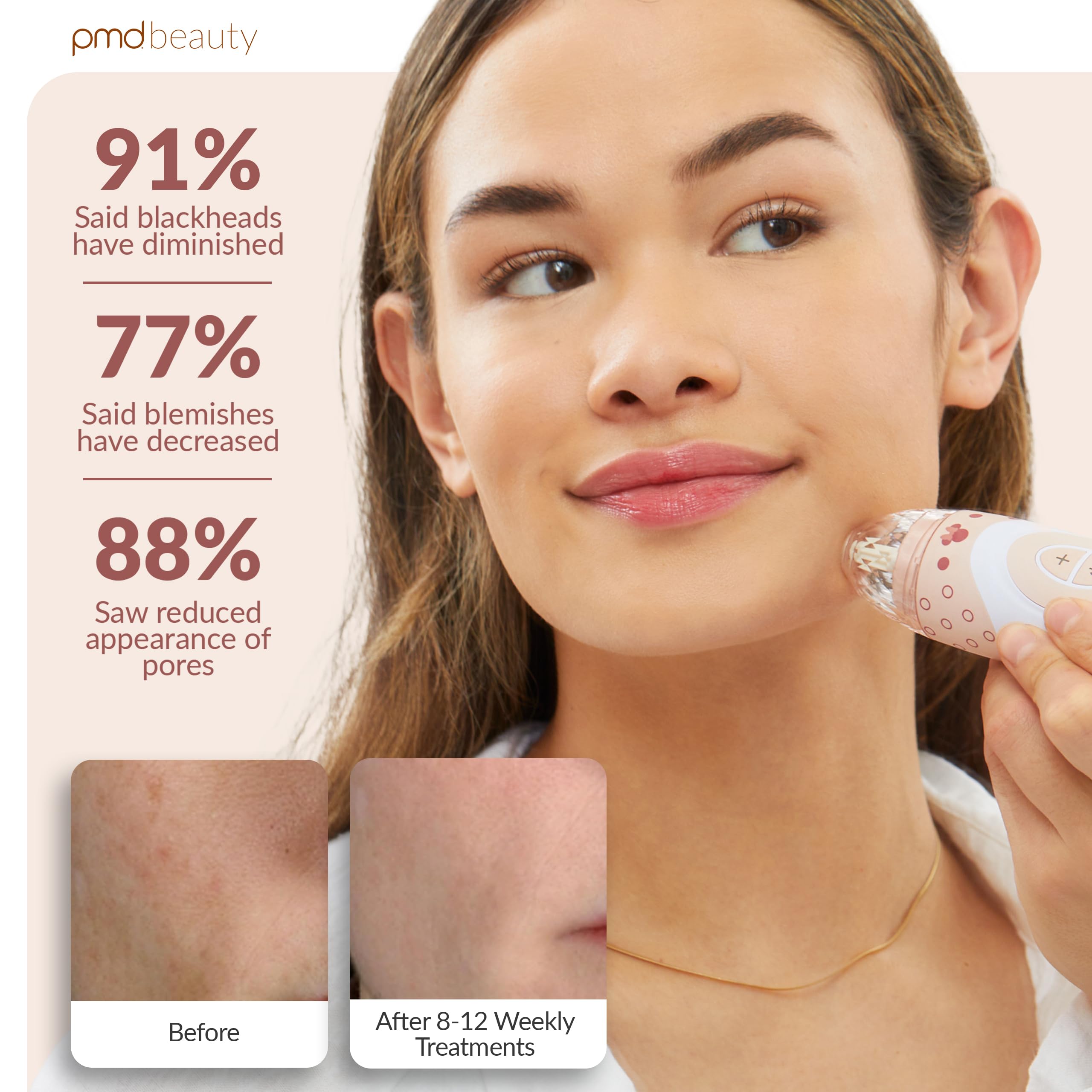 pmd-beauty-x-disney-minnie-mouse-personal-microderm-elite-pro-at-home-microderma image 4