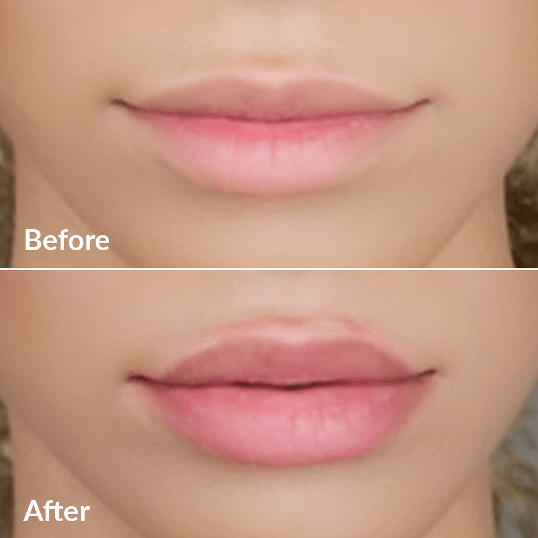 pmd-beauty-kiss-system-lip-plumping-device-with-mask-exfoliator image 8