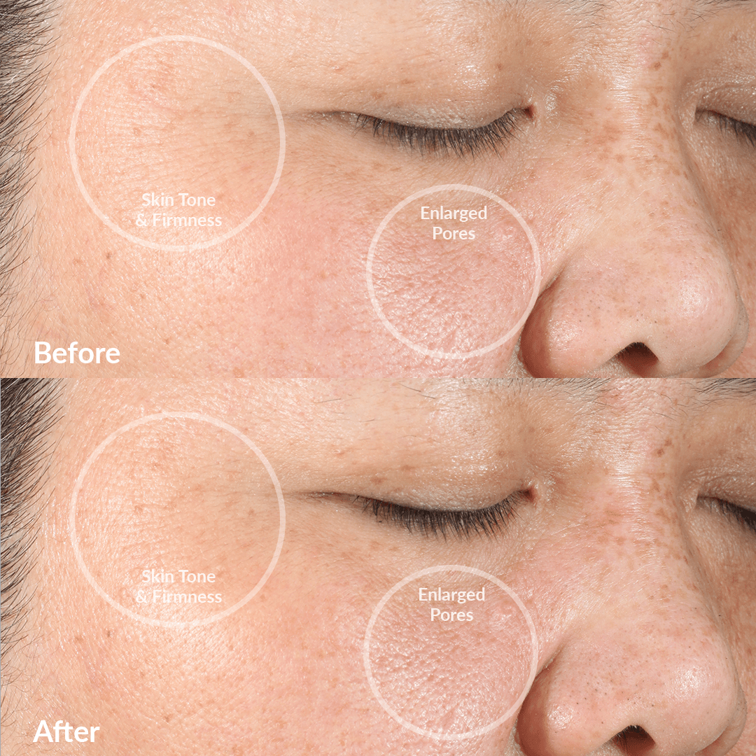 pmd-beauty-clean-sonic-facial-cleansing-device-30-off image 2