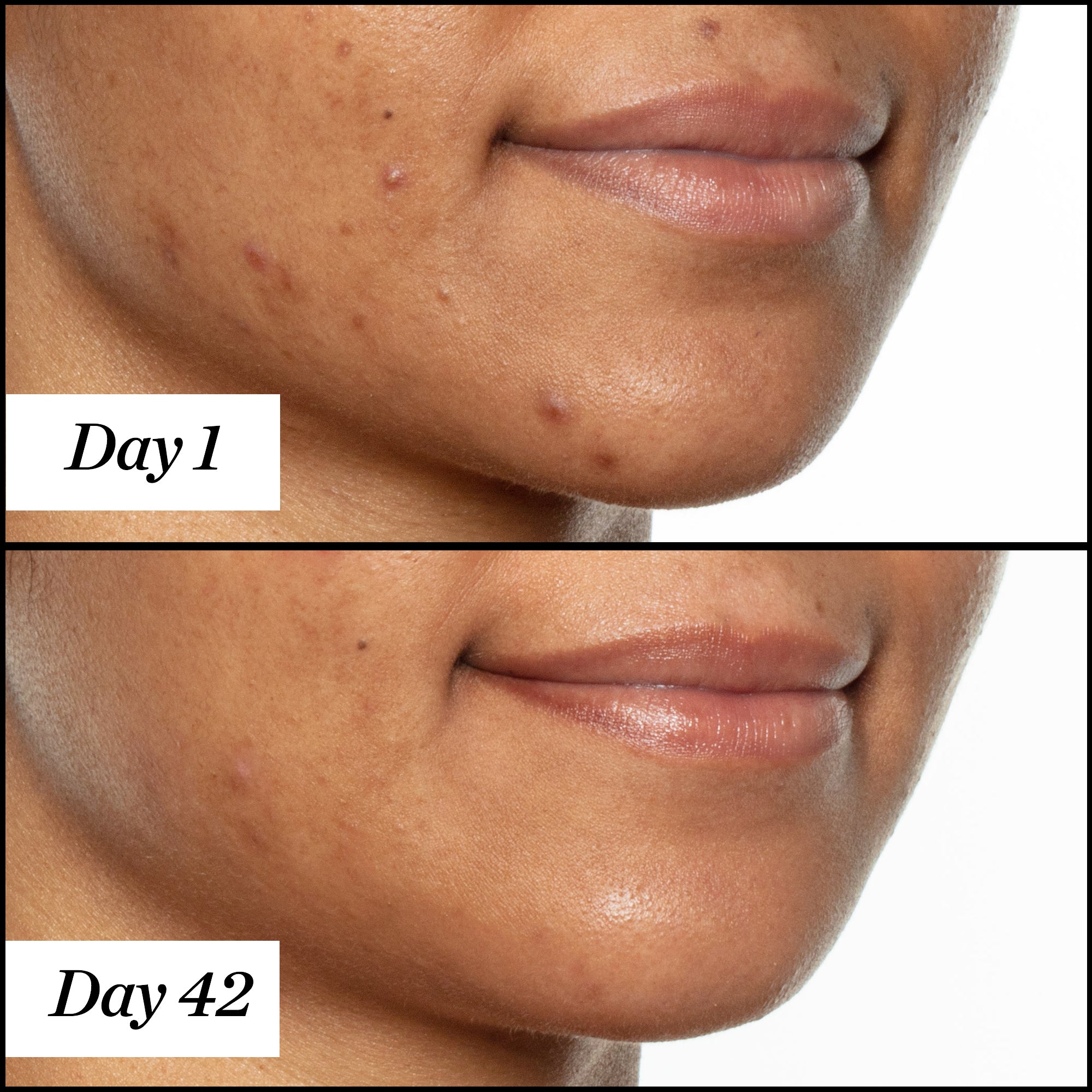 sunday-riley-u-f-o-acne-treatment-face-oil-with-salicylic-acid image 8
