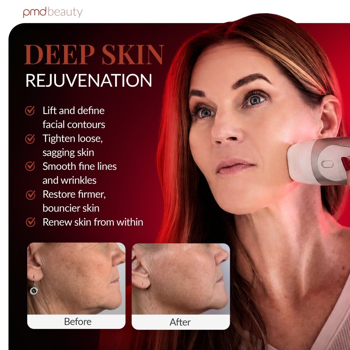pmd-beauty-hifu-non-invasive-skin-tightening-device-korean-hifu-tech image 4