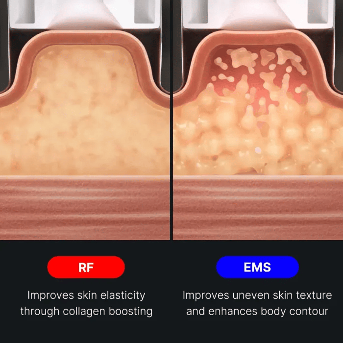 medicube-age-r-contour-body-shot image 5