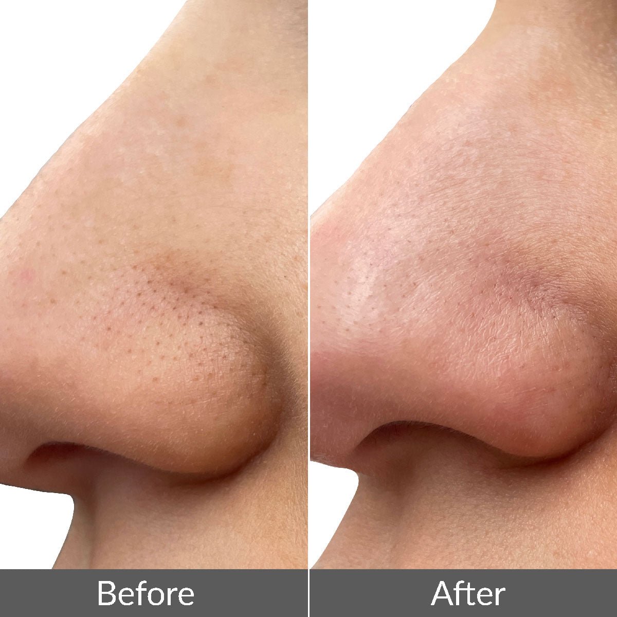 pmd-beauty-wave-pro-for-men-deep-cleansing-toning-device image 3