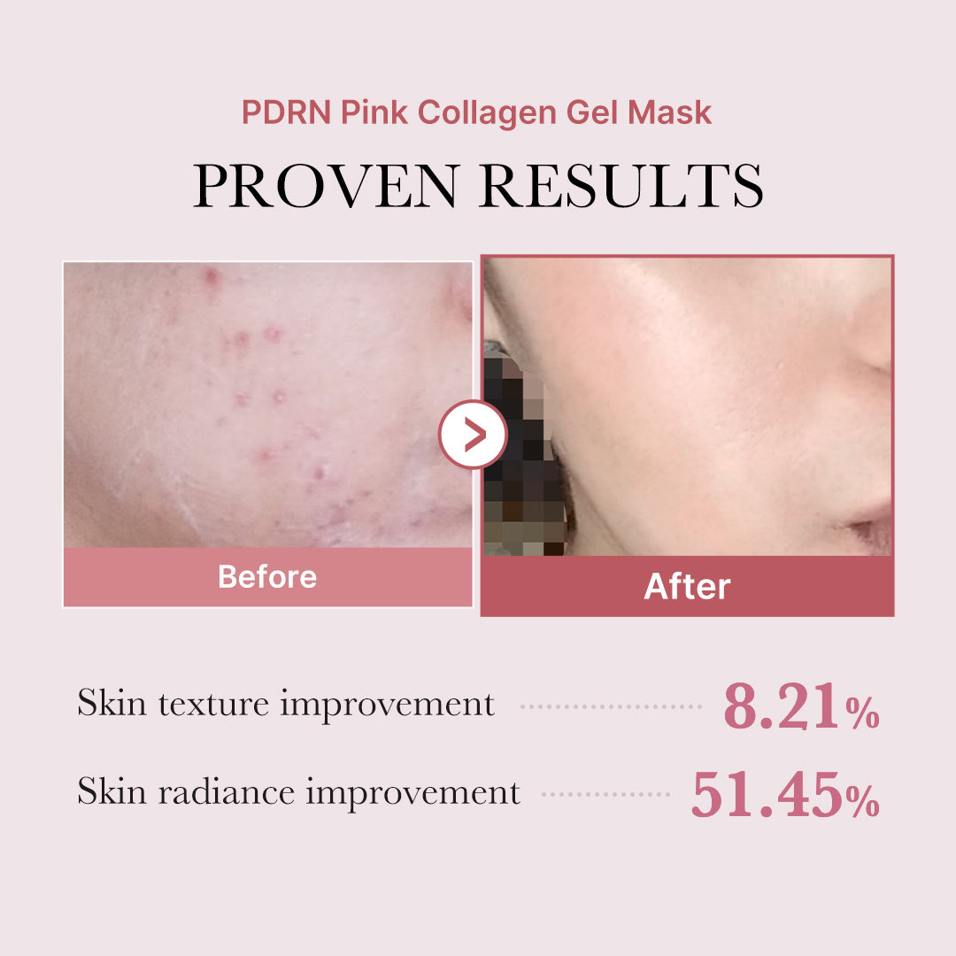 medicube-pdrn-pink-glow-full-set-complete-korean-glass-skin-routine-with-salmon- image 6