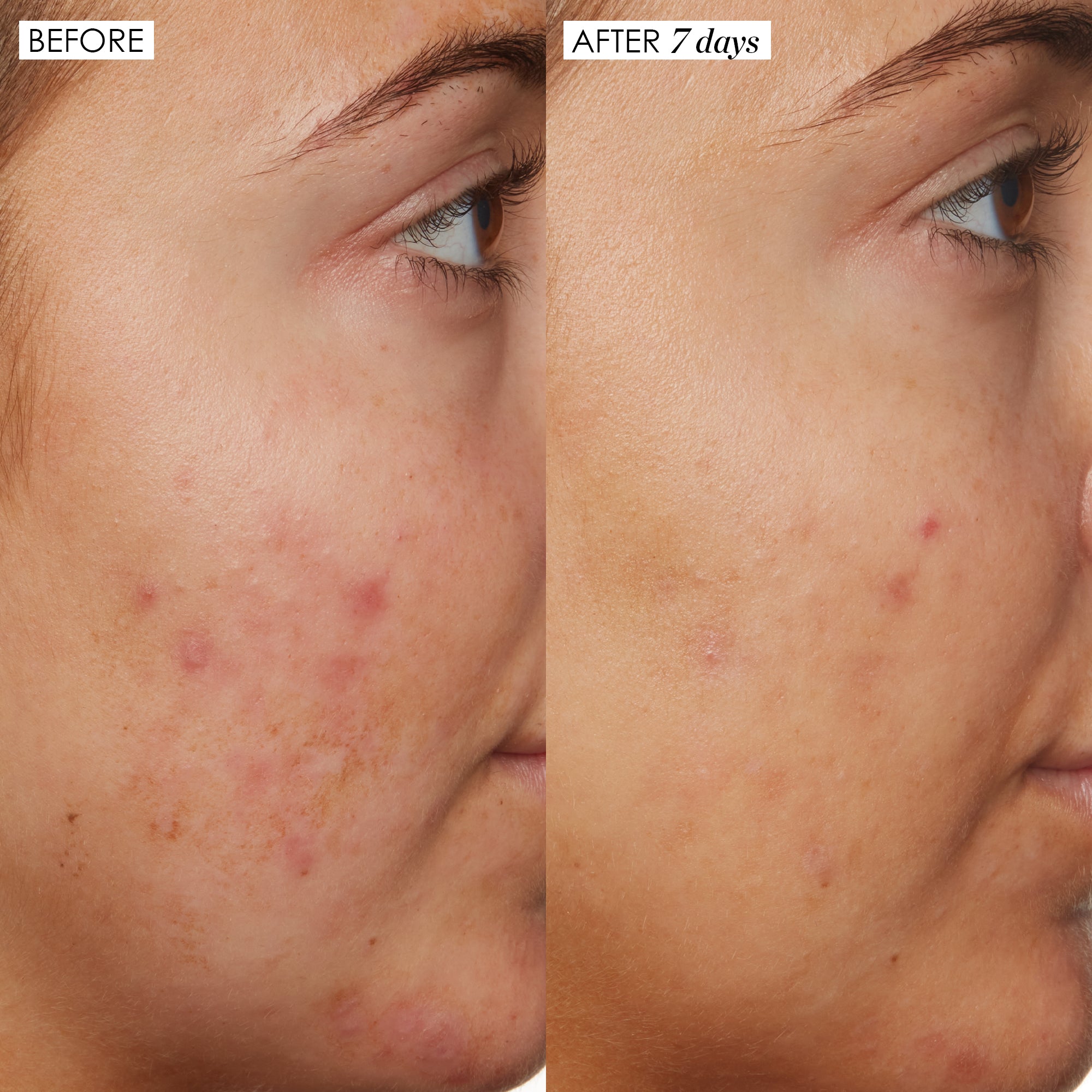 sunday-riley-b3-nice-10-niacinamide-serum image 3