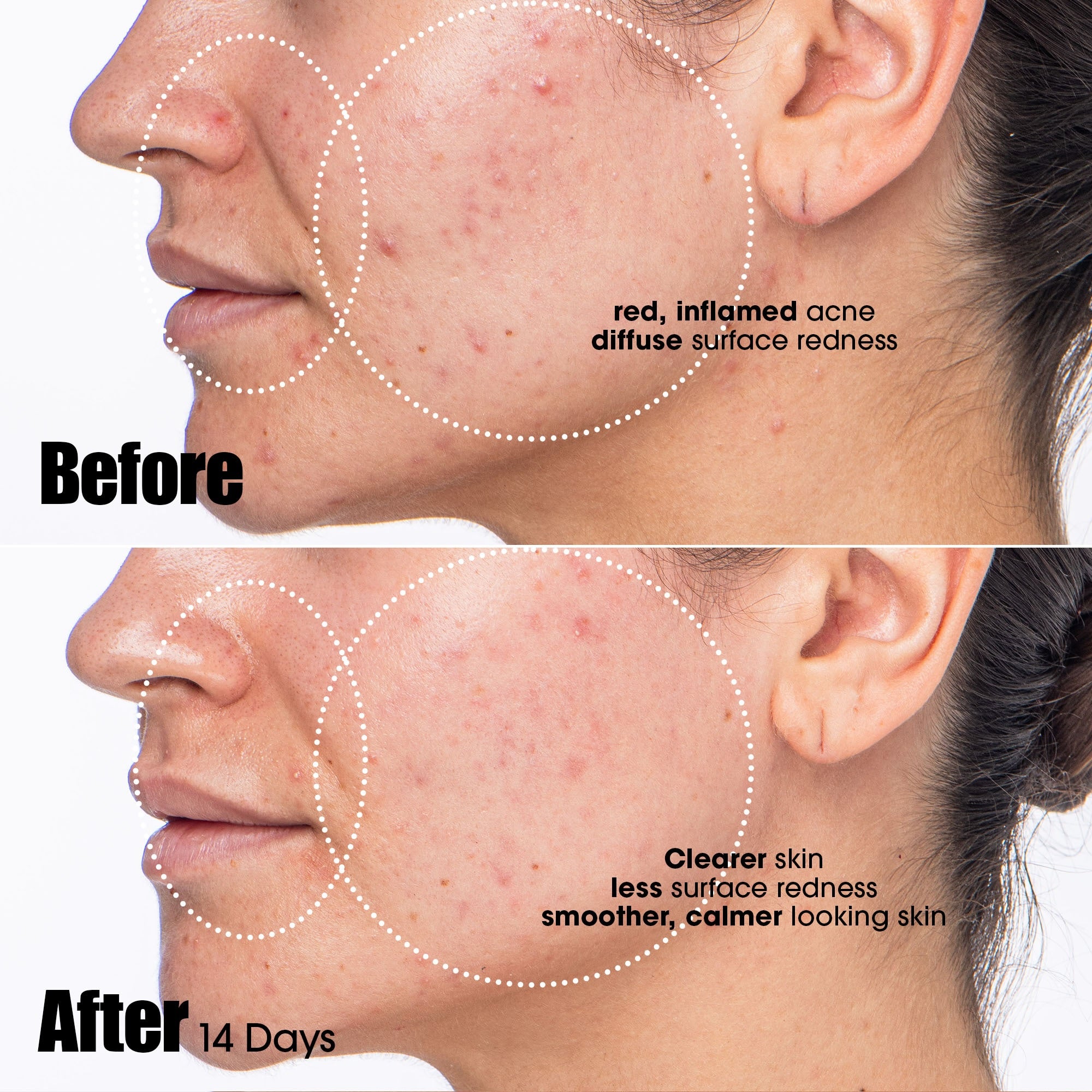 sunday-riley-peacekeeper-acne-treatment-serum image 7