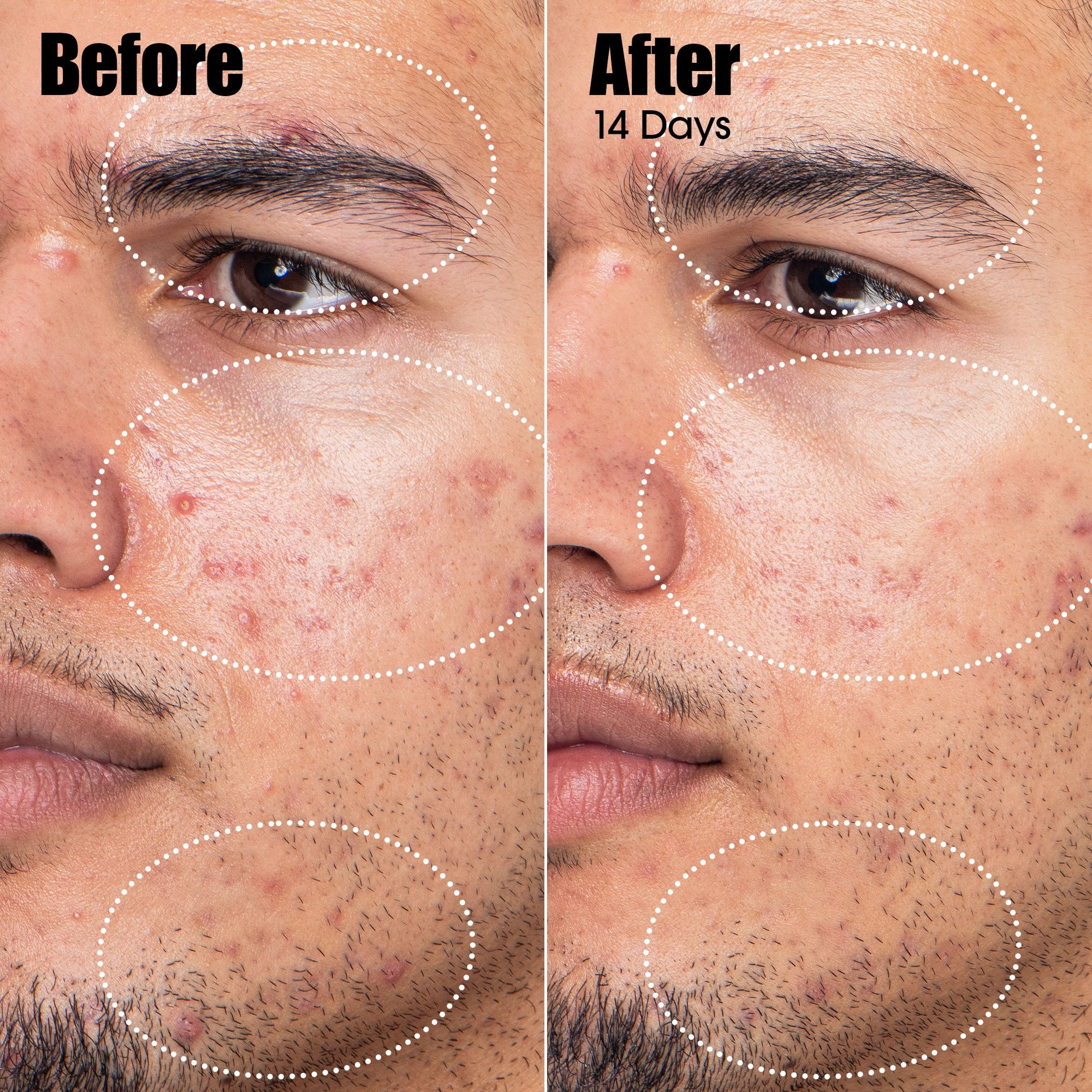 sunday-riley-peacekeeper-acne-treatment-serum image 6