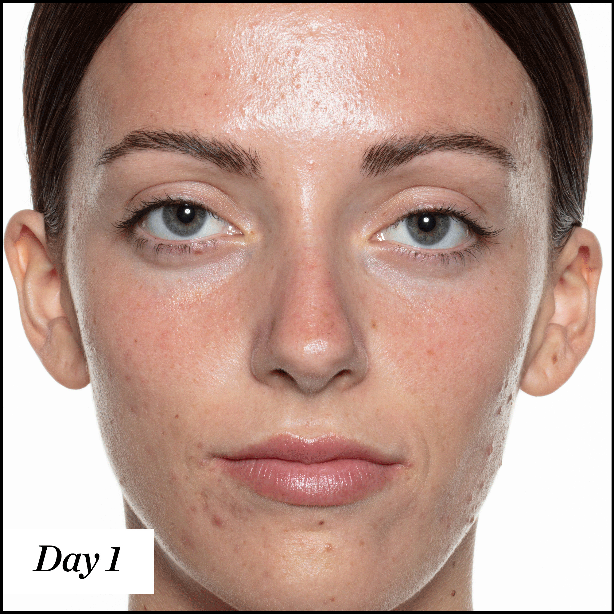 sunday-riley-u-f-o-acne-treatment-face-oil-with-salicylic-acid image 7